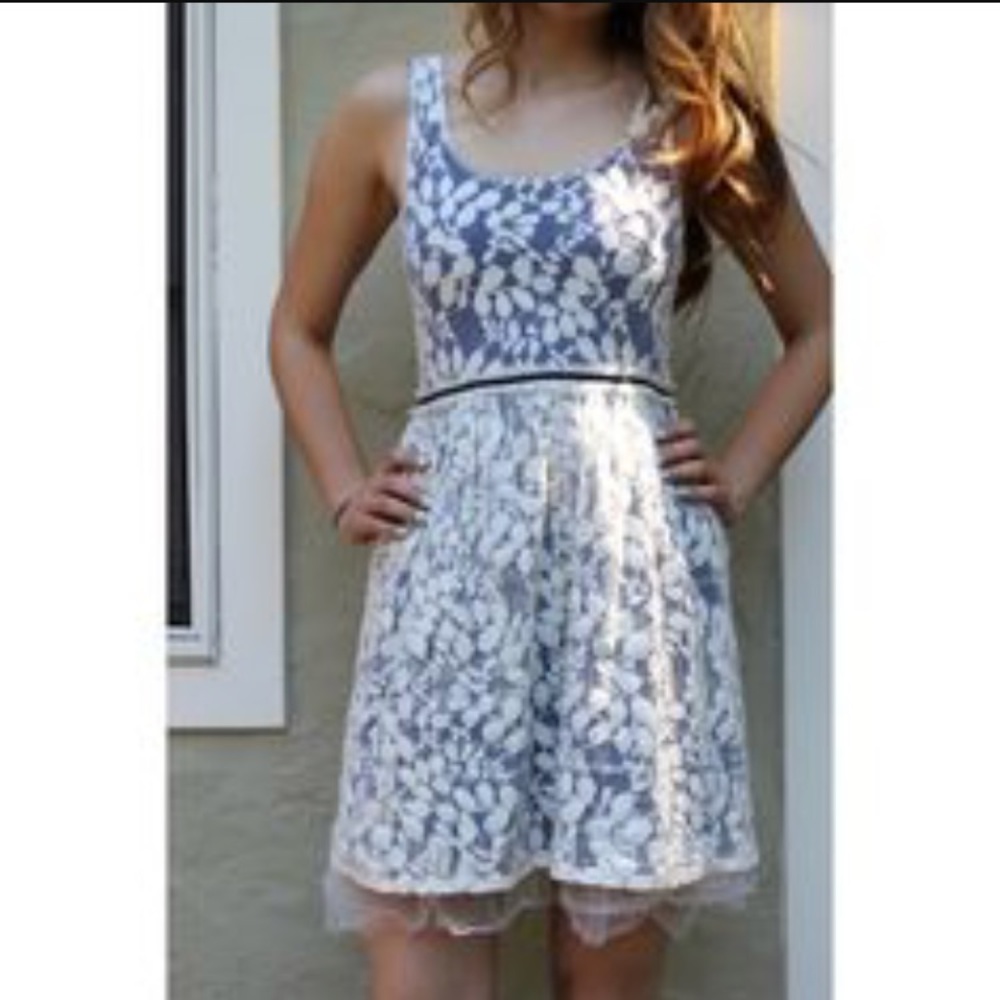 Anthropologie Lace Dress